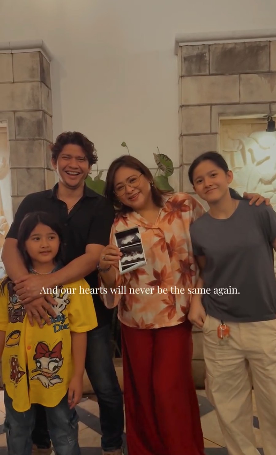 Audy Hamil Anak Ketiga di Usia 43 Tahun, Iko Uwais Ikhlas Soal Jenis Kelamin